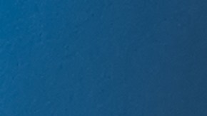 Algunas tomografías computarizadas emiten demasiada radiación