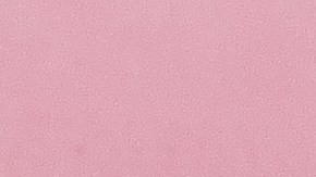 La falla en los Chromecast de segunda generación ha provocado que un gran número de usuarios no pueda utilizar su dispositivo de streaming