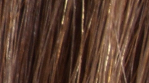 L'Oreal retira del mercado un tratamiento contra el acné