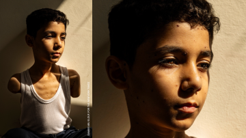 La historia de la impactante imagen de un niño palestino mutilado que ganó el premio World Press Photo 2025