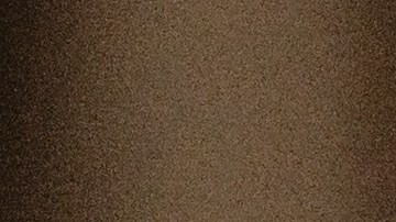 Casos de sarampión en Texas aumentan a 663