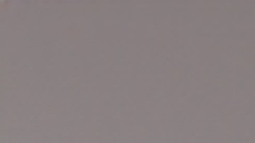 El El Beinao-1 fue implantado en un paciente de 19 años con epilepsia cuyo nombre no ha sido revelado hasta ahora