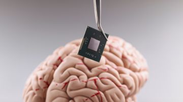 El El Beinao-1 fue implantado en un paciente de 19 años con epilepsia cuyo nombre no ha sido revelado hasta ahora