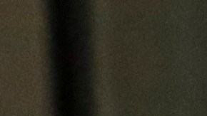 In this Wednesday, Aug. 28, 2019, photo a detainee receives dental treatment at the Adelanto ICE Processing Center in Adelanto, Calif. The facility is a privately operated immigration detention center run by the GEO Group, which can house up to about 1900 total immigrant detainees, both male and female. (AP Photo/Chris Carlson)