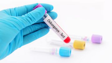 Advierten a adultos mayores que no reciban la vacuna contra el chikungunya: por qué
