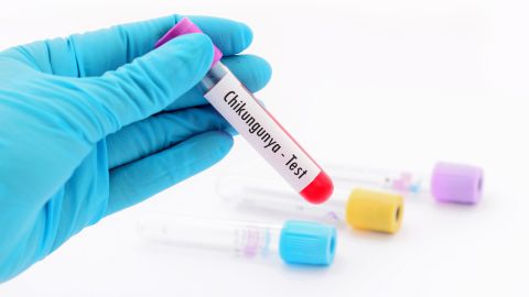 Advierten a adultos mayores que no reciban la vacuna contra el chikungunya: por qué