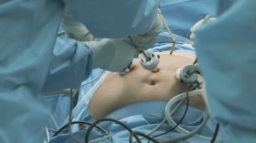 Cada vez más adolescentes estadounidenses se someten a cirugía para perder peso