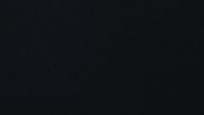 Emanuel Navarrete después del cabezazo que le abrió la ceja.