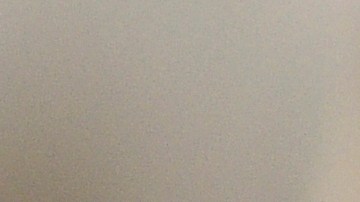 Khloé Kardashian revela todos sus secretos estéticos tras años de especulaciones