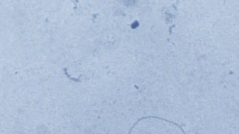 Listeria