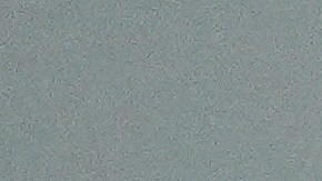 A 4-year-old Mexican girl, who has short bowel syndrome, attends a news conference in Los Angeles, Wednesday, May 28, 2025, after her and her mother's humanitarian parole was terminated and they were ordered to self-deport. (AP Photo/Jae C. Hong)