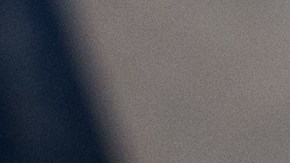 Surgical instruments are used during a kidney transplant surgery at MedStar Georgetown University Hospital in Washington D.C., Tuesday, June 28, 2016. (AP Photo/Molly Riley)