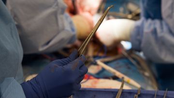 Surgical instruments are used during a kidney transplant surgery at MedStar Georgetown University Hospital in Washington D.C., Tuesday, June 28, 2016. (AP Photo/Molly Riley)