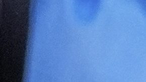 Bayern Munich's Jamal Musiala is taken off the field after an injury during the Club World Cup quarterfinal soccer match between PSG and Bayern Munich in Atlanta, Saturday, July 5, 2025. (AP Photo/Brynn Anderson)