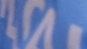 Musiala instantes después de su lesión.