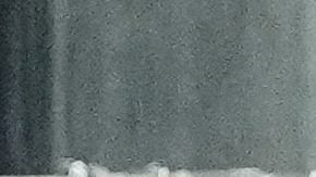 Bayern Munich's Jamal Musiala lies on the ground during the Club World Cup quarterfinal soccer match between PSG and Bayern Munich in Atlanta, Saturday, July 5, 2025. (AP Photo/Mike Stewart)