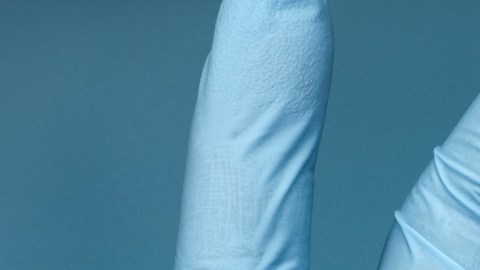 No esperes que lleguen los cólicos nefríticos, atiende con tiempo las piedras en los riñones