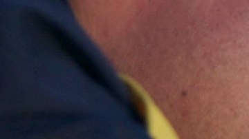 Golpes en la cabeza: cuándo deben ser tomados muy en cuenta