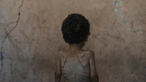 Se estima que más de 100 personas ya han muerto de inanición en Gaza.