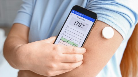 Si no tienes diabetes, ¿es necesario monitorear continuamente el azúcar en la sangre?