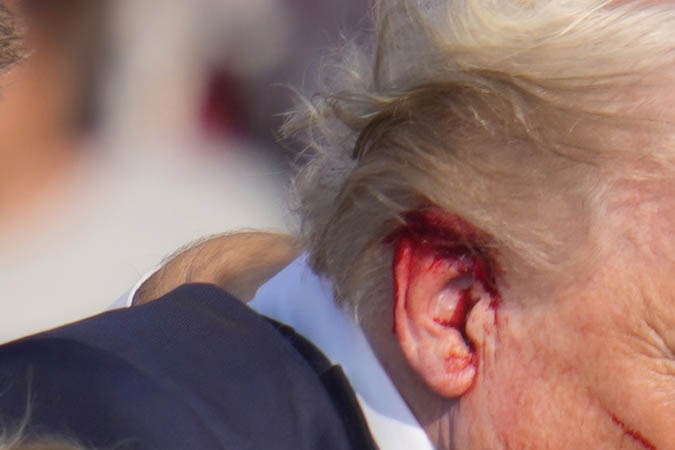 Donald Trump herido durante un atentado en su contra
