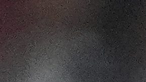 Los Angeles Dodgers starting pitcher Shohei Ohtani, right, is tended to by a trainer, center, with the help of an interpreter after Ohtani took an RBI single off the bat of Colorado Rockies' Orlando Arcia in the leg in the fourth inning of a baseball game, Wednesday, Aug. 20, 2025, in Denver. (AP Photo/David Zalubowski)