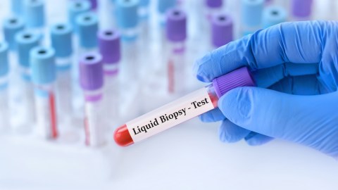 ¿Es posible una vacuna única contra el cáncer?: comprendiendo su complejidad