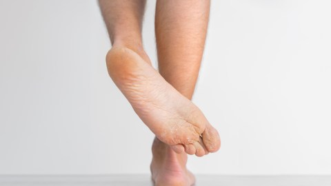 Protégete de los hongos en los pies con estos sencillos pasos