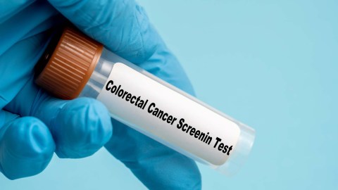 Sugieren que bebidas azucaradas tienen incidencia directa en la propagación del cáncer colorrectal