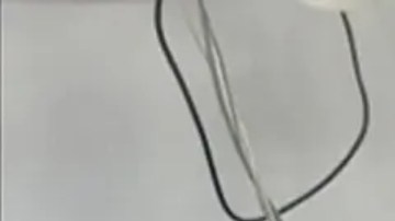 Las médicas australianas Saya Aziz y Nada Abu Alrub con Mohamed, un paciente de 13 años que quedó parcialmente paralizado tras un ataque israelí.