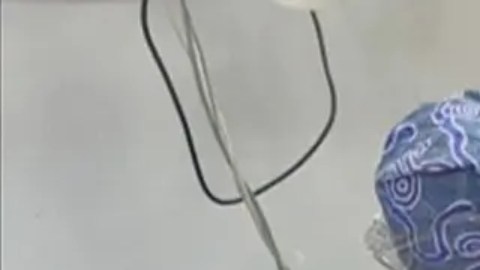 Las médicas australianas Saya Aziz y Nada Abu Alrub con Mohamed, un paciente de 13 años que quedó parcialmente paralizado tras un ataque israelí.