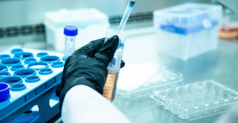 Identifican bacteria que puede destruir células cancerosas