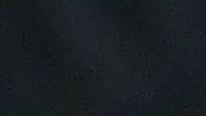 Toluca, Estado de México, 26 de octubre de 2025. Alexis Vega resulto lesionado , durante el partido correspondiente a la jornada 15 del torneo Apertura 2025 de la Liga BBVA MX, entre los Diablos Rojos del Toluca y los Tuzos del Pachuca, realizado en el estadio Nemesio Diez. Foto: Imago7/ Arturo Hernández