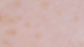 In this Friday, July 21, 2017 photo, a woman is handcuffed after being searched by police for suspected drug paraphernalia at a city park in Delray Beach, Fla. As drug addiction destroys families across America, “there’s a need for a positive, vibrant recovery network to help people get off of opioids,” said State Attorney Dave Aronberg, chief prosecutor in Palm Beach County. “You can’t just arrest your way out of this problem.” But lately, South Florida has become the focal point of rampant insurance fraud that relies on a lethal cycle of failure, authorities say. (AP Photo/Lynne Sladky)