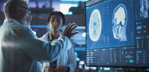 Análisis de la forma cerebral puede predecir riesgo de demencia años antes de la aparición de los síntomas