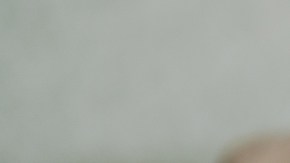 ¡Señales de alerta! 1 de cada 3 personas en el mundo tiene trastornos neurológicos, según la OMS