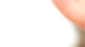 ¡No es solo problema de adolescentes! El acné está aumentando de forma significativa en adultos, advierte dermatóloga