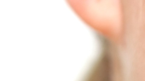 ¡No es solo problema de adolescentes! El acné está aumentando de forma significativa en adultos, advierte dermatóloga