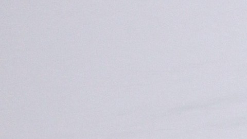 Gaby Spanic causa asombro con su nuevo rostro y revela los procedimientos estéticos