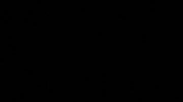 Kim Kardashian revela que tiene 'baja actividad cerebral' tras un aneurisma que padeció durante años