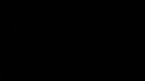 Kim Kardashian revela que tiene 'baja actividad cerebral' tras un aneurisma que padeció durante años