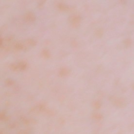 In this Friday, July 21, 2017 photo, a woman is handcuffed after being searched by police for suspected drug paraphernalia at a city park in Delray Beach, Fla. As drug addiction destroys families across America, “there’s a need for a positive, vibrant recovery network to help people get off of opioids,” said State Attorney Dave Aronberg, chief prosecutor in Palm Beach County. “You can’t just arrest your way out of this problem.” But lately, South Florida has become the focal point of rampant insurance fraud that relies on a lethal cycle of failure, authorities say. (AP Photo/Lynne Sladky)