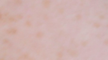 In this Friday, July 21, 2017 photo, a woman is handcuffed after being searched by police for suspected drug paraphernalia at a city park in Delray Beach, Fla. As drug addiction destroys families across America, “there’s a need for a positive, vibrant recovery network to help people get off of opioids,” said State Attorney Dave Aronberg, chief prosecutor in Palm Beach County. “You can’t just arrest your way out of this problem.” But lately, South Florida has become the focal point of rampant insurance fraud that relies on a lethal cycle of failure, authorities say. (AP Photo/Lynne Sladky)