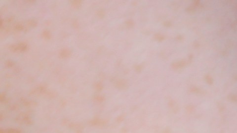 In this Friday, July 21, 2017 photo, a woman is handcuffed after being searched by police for suspected drug paraphernalia at a city park in Delray Beach, Fla. As drug addiction destroys families across America, “there’s a need for a positive, vibrant recovery network to help people get off of opioids,” said State Attorney Dave Aronberg, chief prosecutor in Palm Beach County. “You can’t just arrest your way out of this problem.” But lately, South Florida has become the focal point of rampant insurance fraud that relies on a lethal cycle of failure, authorities say. (AP Photo/Lynne Sladky)