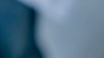 "Baby Botox": la tendencia entre jóvenes para mantenerse libres de arrugas