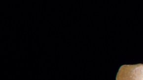 ¿Alternativa segura? Tecnología de ARNm podría reducir discapacidades en personas con mordeduras de serpientes