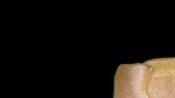 ¿Alternativa segura? Tecnología de ARNm podría reducir discapacidades en personas con mordeduras de serpientes