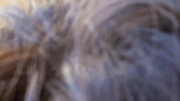 Inyecciones mensuales contra el asma, un tratamiento alternativo a los esteroides diarios