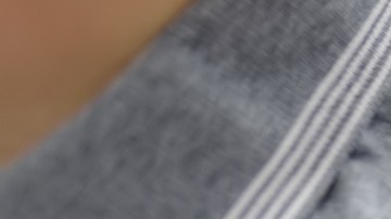 Canadá ya no es un país libre de sarampión tras brotes continuos