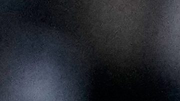 Kylian Mbappé sufrió una rotura en el dedo de la mano izquierda durante el encuentro pasado.